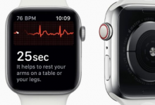 苹果Watch被诊断为医生的严重心脏病最终挽救了他的生命
